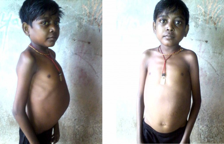 Sick boy needs support for treatment